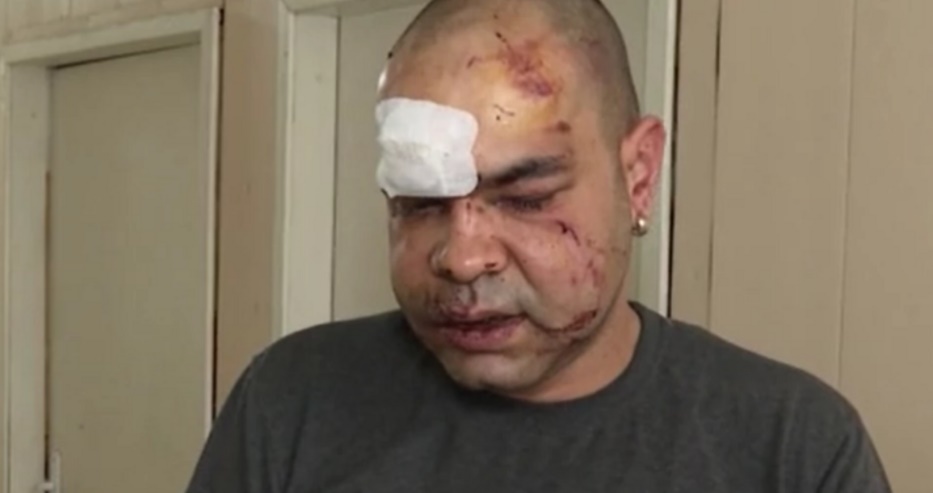Ужас във Враца: Пребиха спешен медик пред дома му, нападателят първо му поискал цигара, после…